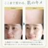 Thumbnail of new posts 086