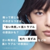 Thumbnail of new posts 043